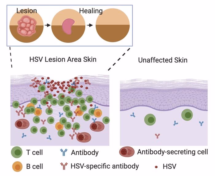 What is a type-specific herpes simplex virus (HSV) glycoprotein G assay?