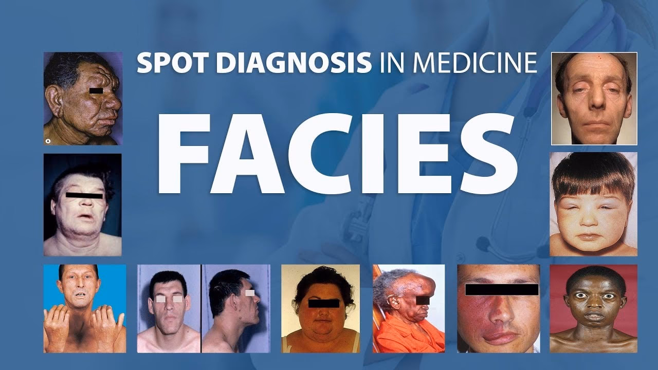 What is a facies in medical terms?