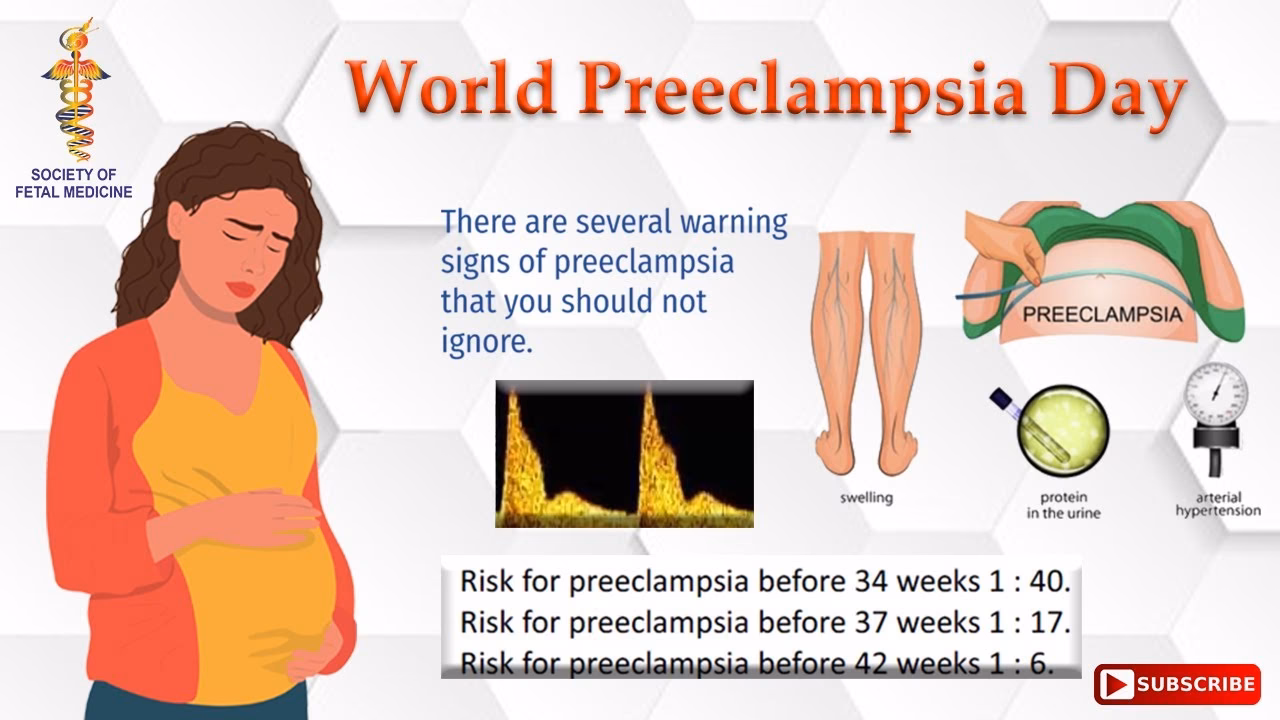 Does the Fetal Medicine Foundation model predict preterm eclampsia?