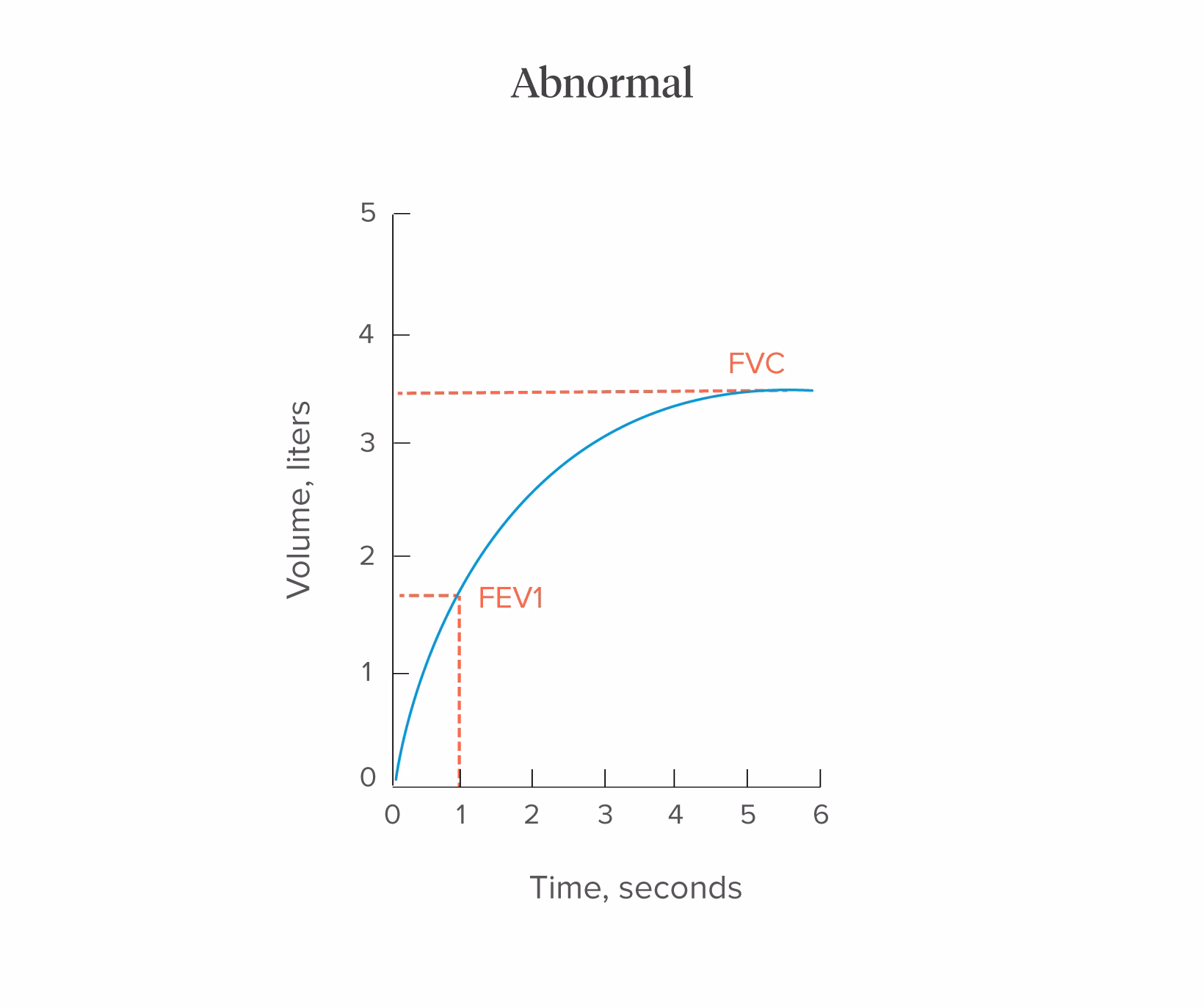 What does FEV1 mean in a pulmonary function test?