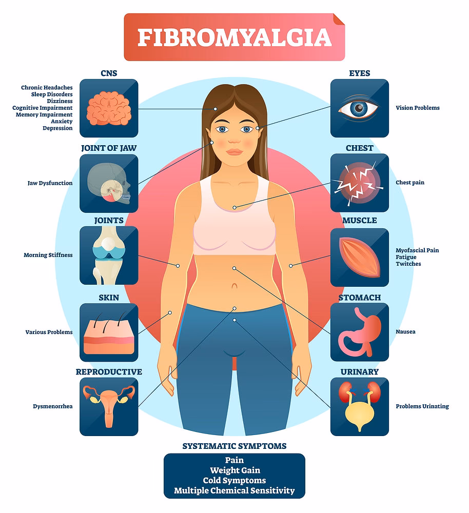 What age does fibromyalgia start?