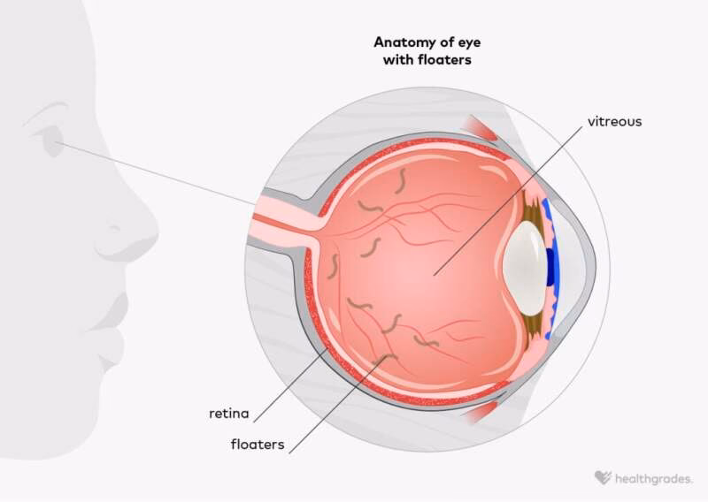 What does an ophthalmologist do for fibromyalgia?