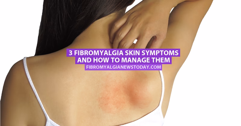Can fibromyalgia itch go away?