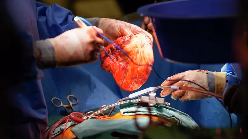 When was the first heart transplant done in India?