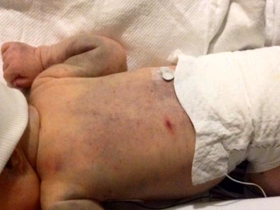 What is the mechanism of fnait?