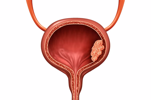 What is direct fulguration?