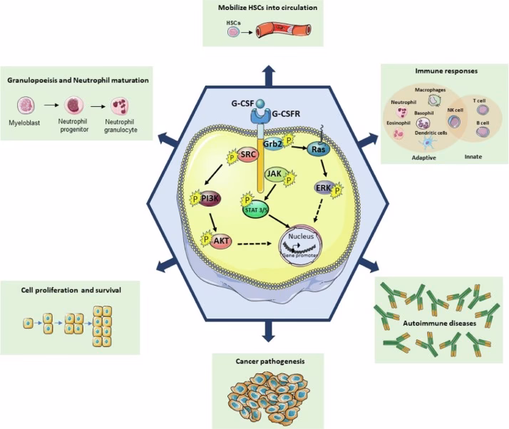 Is G-CSF a marker for gastric cancer?