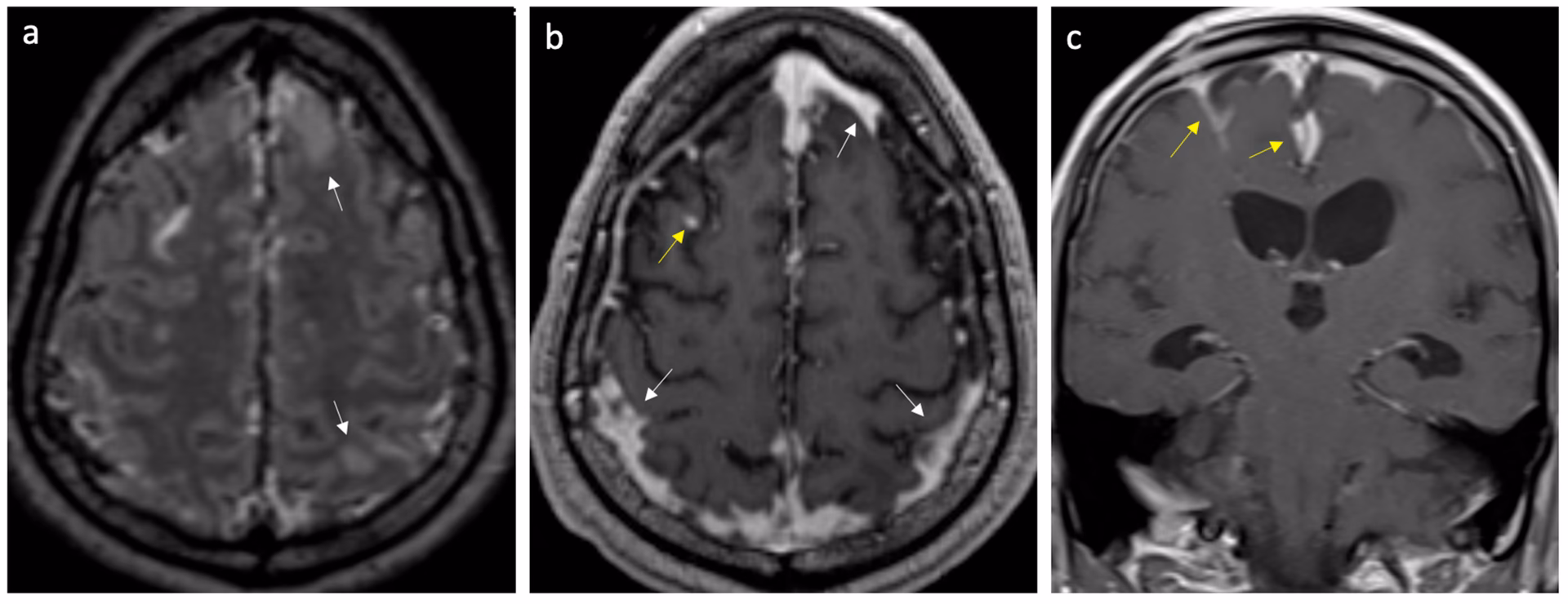 What does g03.9 mean?