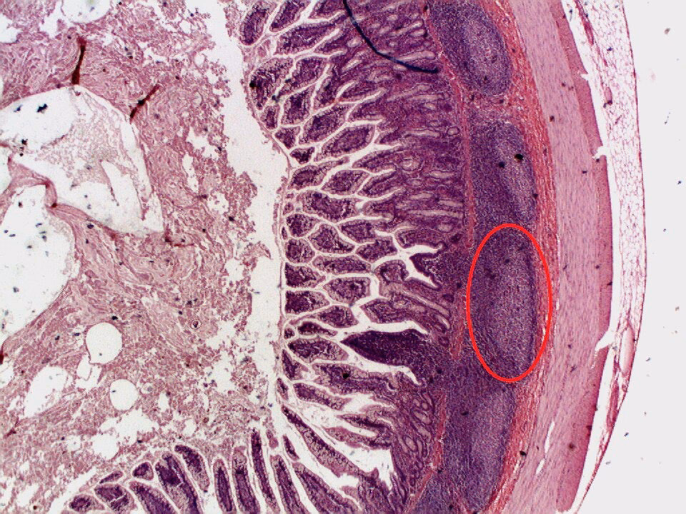 What is gut-associated lymphoid tissue (GALT)?