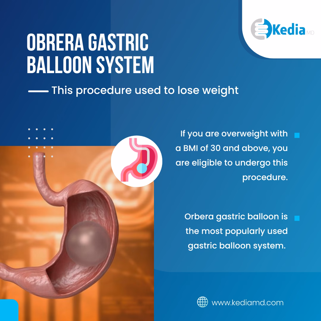 How much does a gastric balloon procedure cost at bariendo?