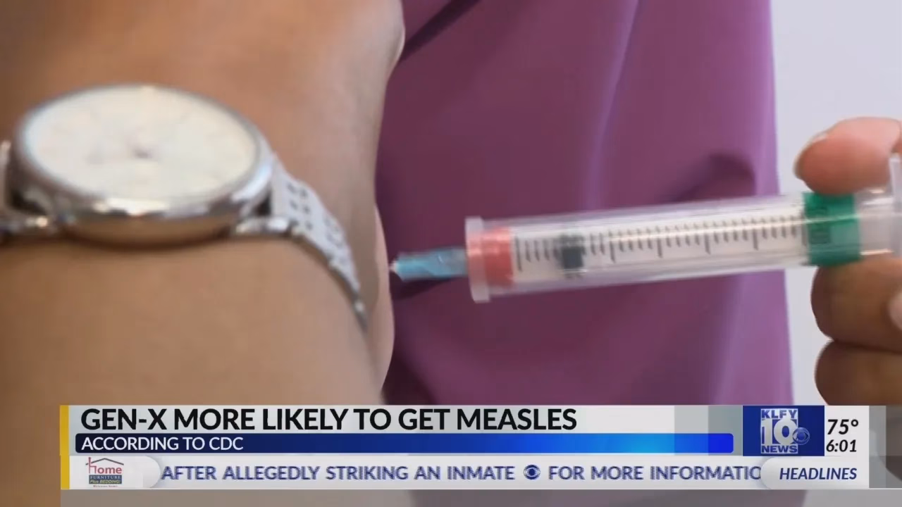 Should healthcare providers be on alert for measles?