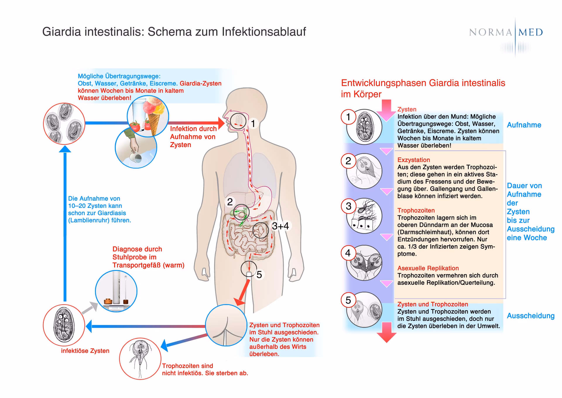Wie kann man eine Ansteckung mit einer Giardiasis vermeiden?