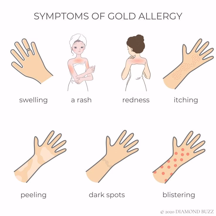 Can a gold allergy cause a rash?