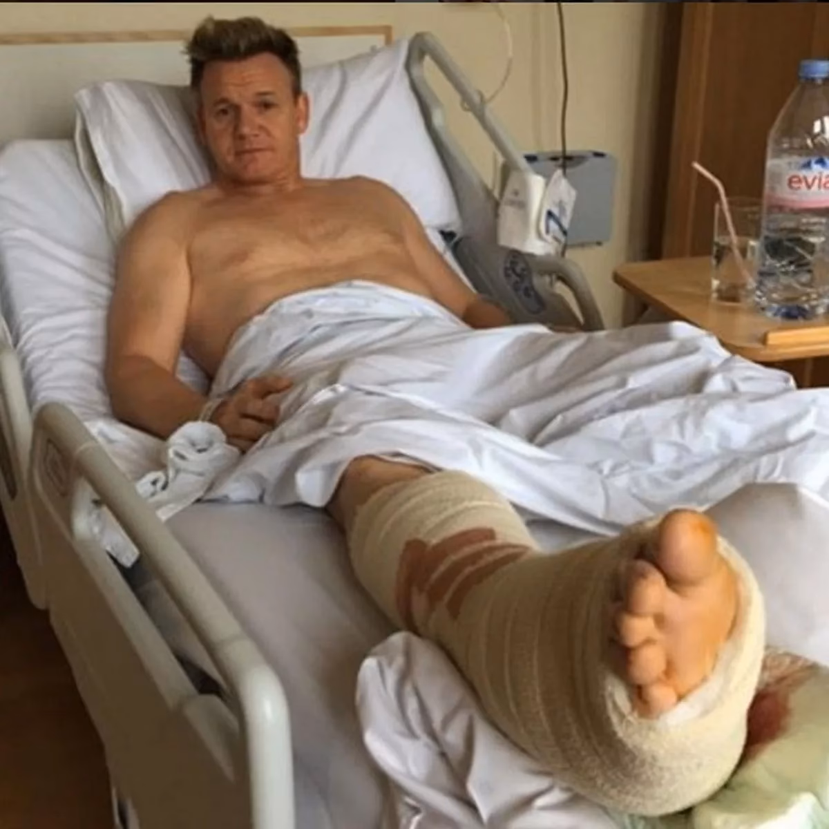 Does Gordon Ramsay need emergency surgery?