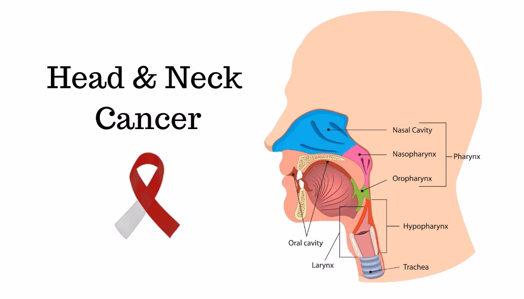 What is the head and neck cancers fact sheet?