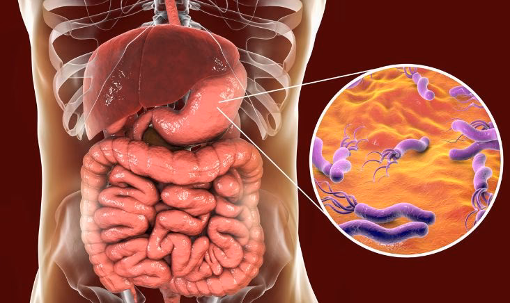 Can anti-Helicobacter pylori treat irritable bowel syndrome?