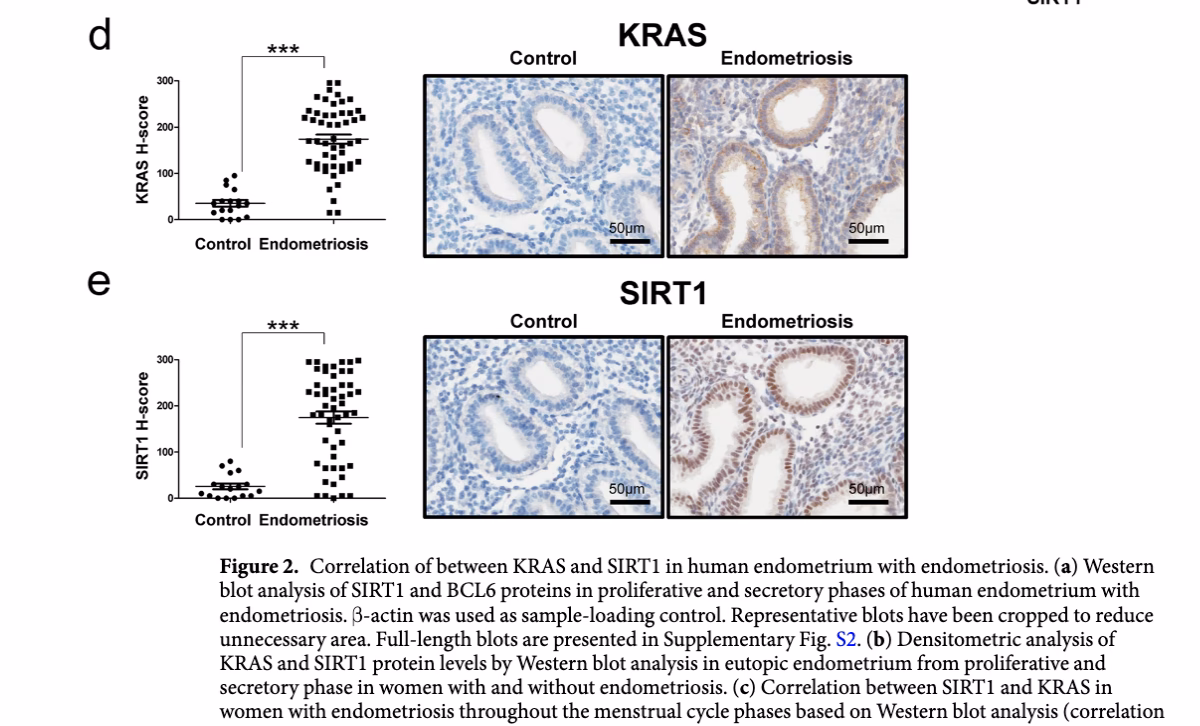 Can the ASRM classification of endometriosis be improved?