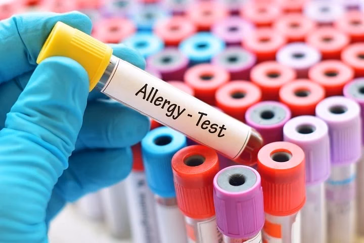 Can a hair sample be used for a food allergy test?