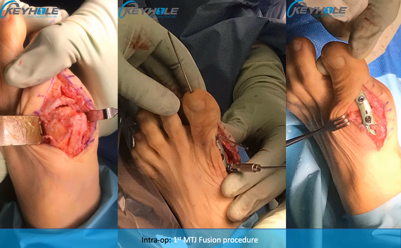 Welche Faktoren sind bei der klinischen Untersuchung des Hallux rigidus wichtig?