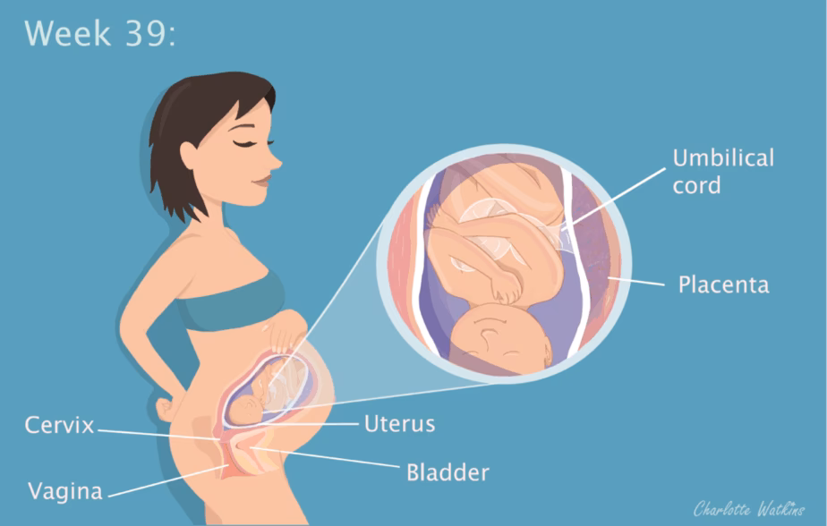 Can caffeine cause headaches during pregnancy?