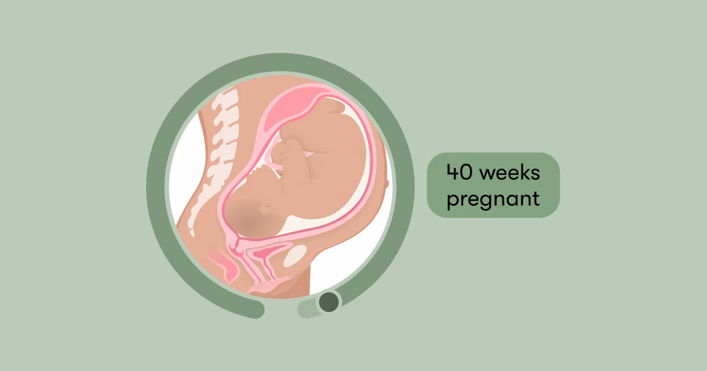 Are headaches common during pregnancy?