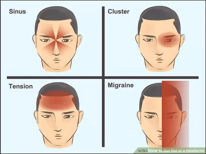 When did headache bands become popular?