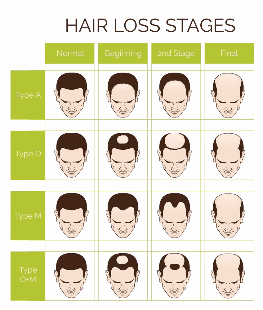 Can a weight loss diet cause headaches?
