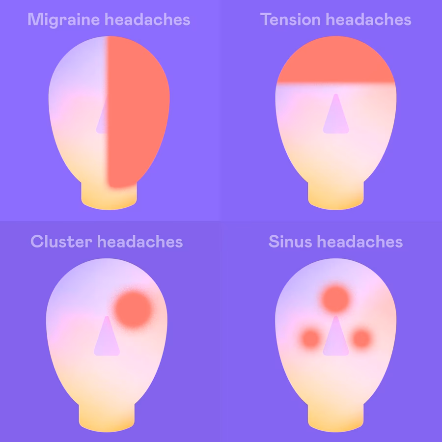 What is a period headache?