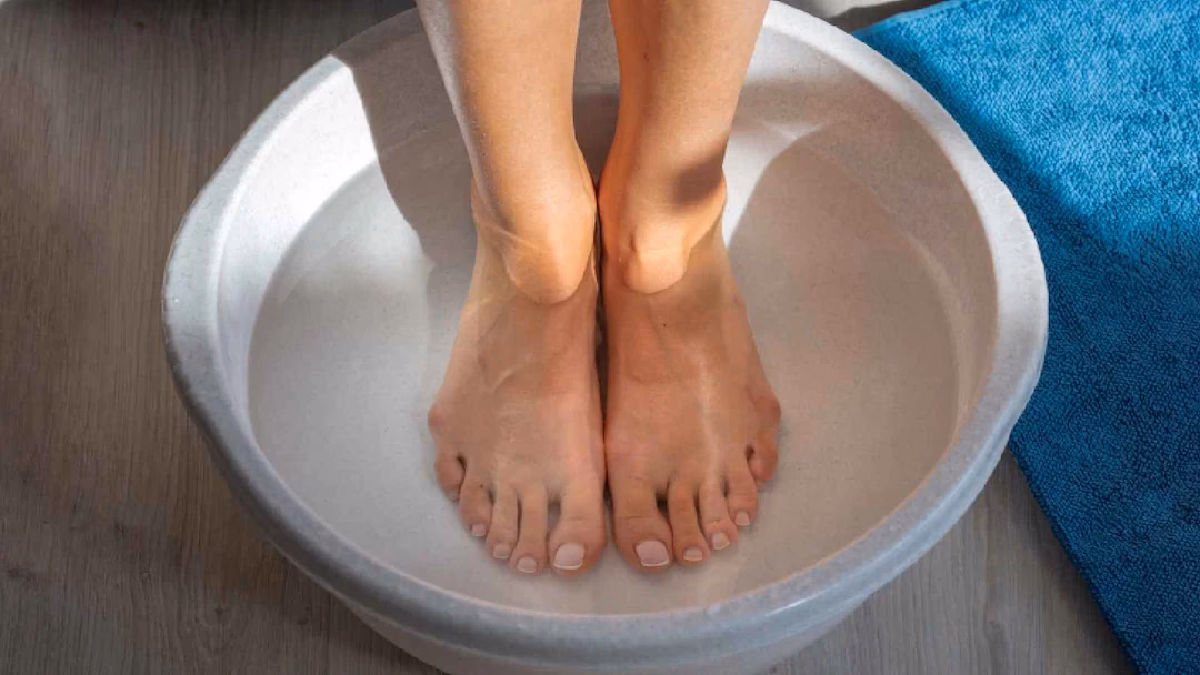 Can boiling a kettle help a migraine?