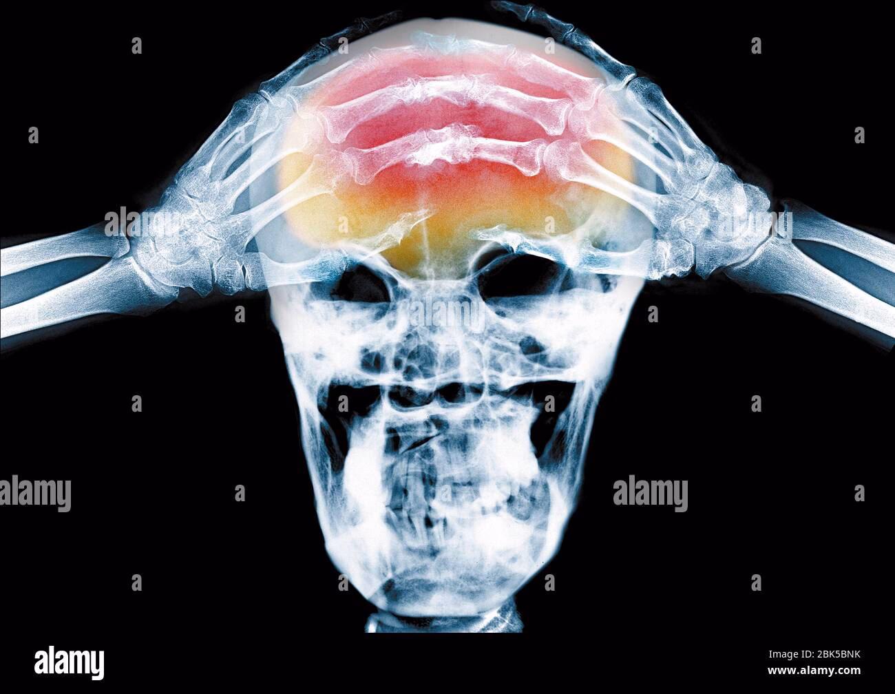 How do doctors diagnose headaches?