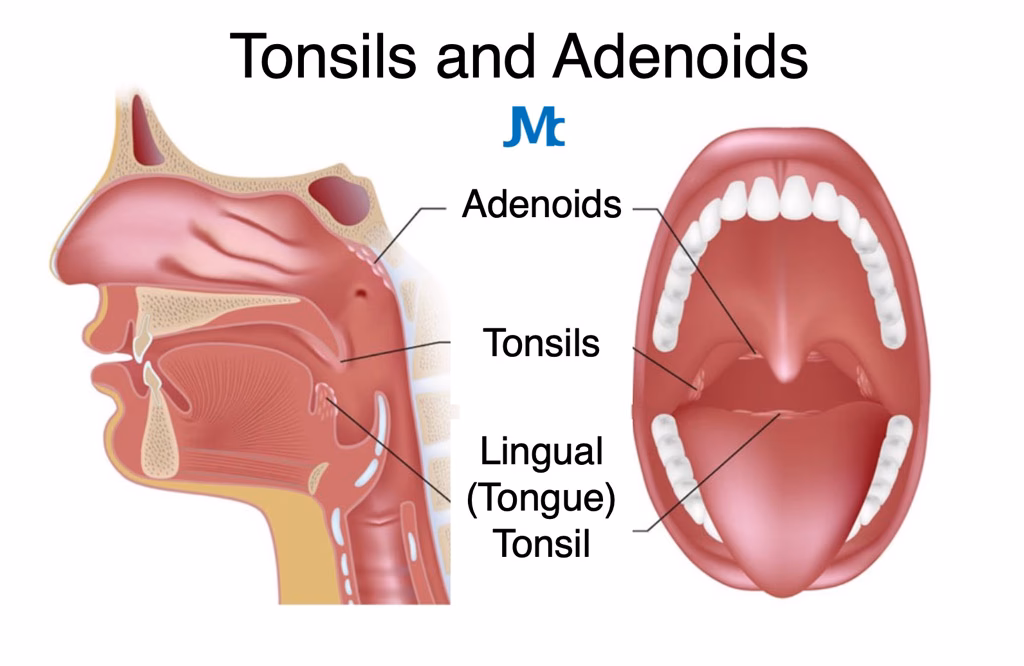 How long does a sore throat last after a tonsillectomy & adenoidectomy?