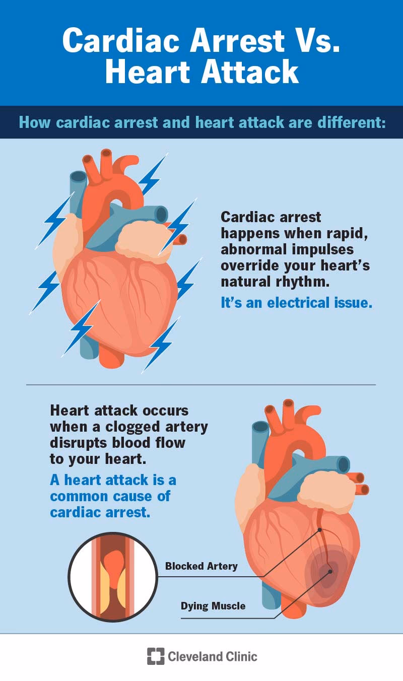 How long do you stay in hospital after a heart attack?