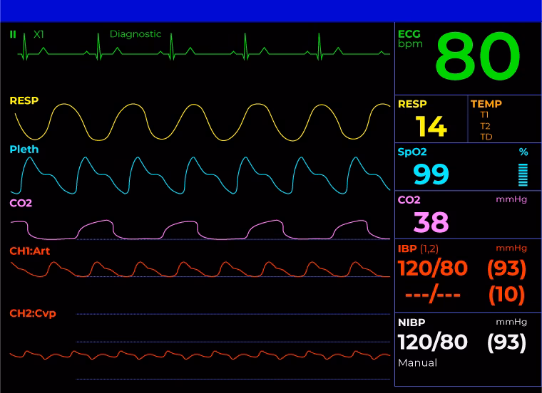 How do you read a hospital monitor?
