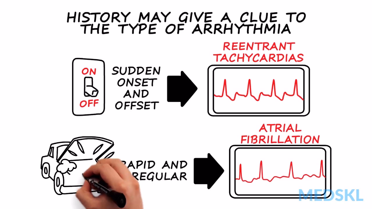 Do you have heart palpitations?