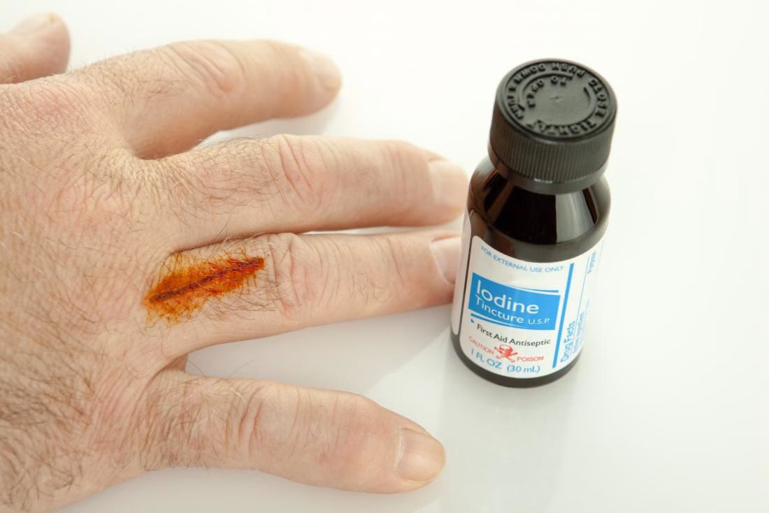 Can iodine deficiency cause arrhythmia?