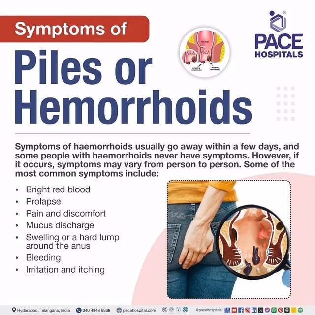 How do you know if a man has a hemorrhoid?