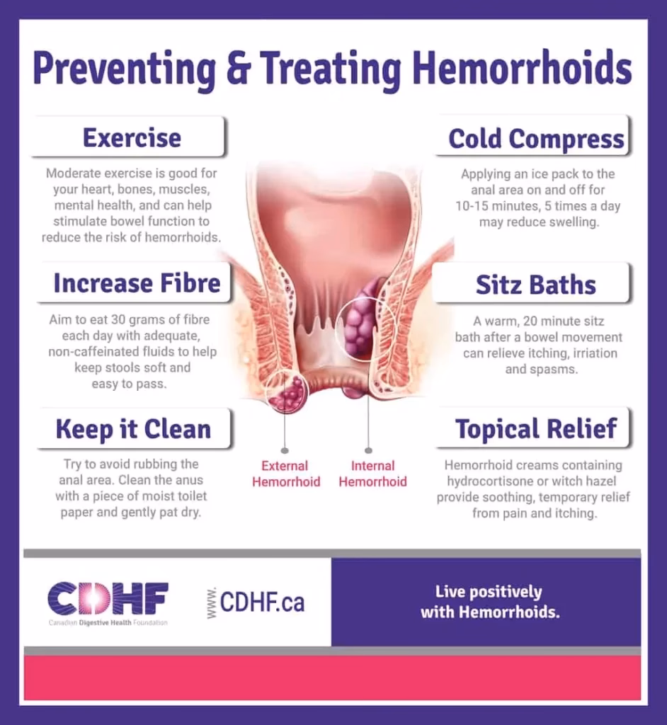 How can I prevent haemorrhoids from returning?