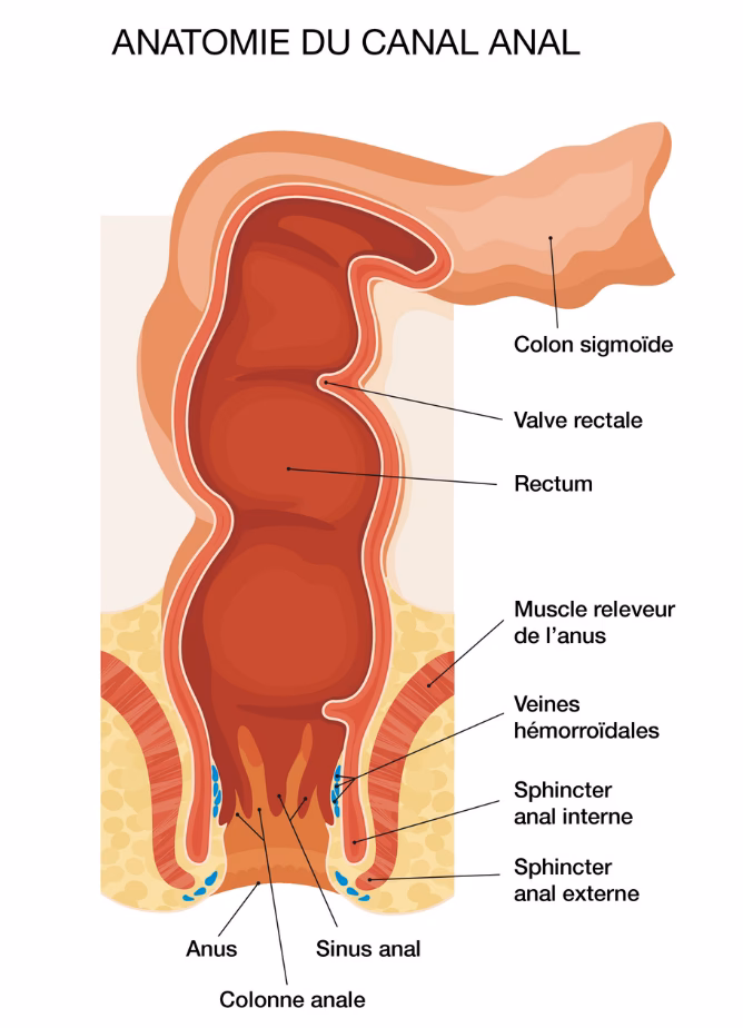 Quels sont les différents types d’hémorroïdes ?