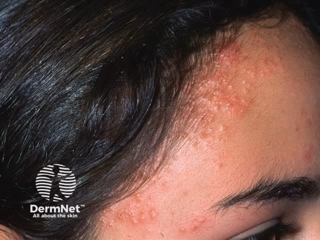 Are henna-based hair dyes PPD free?