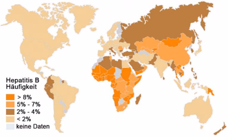 Where is hepatitis A affecting Hungary?