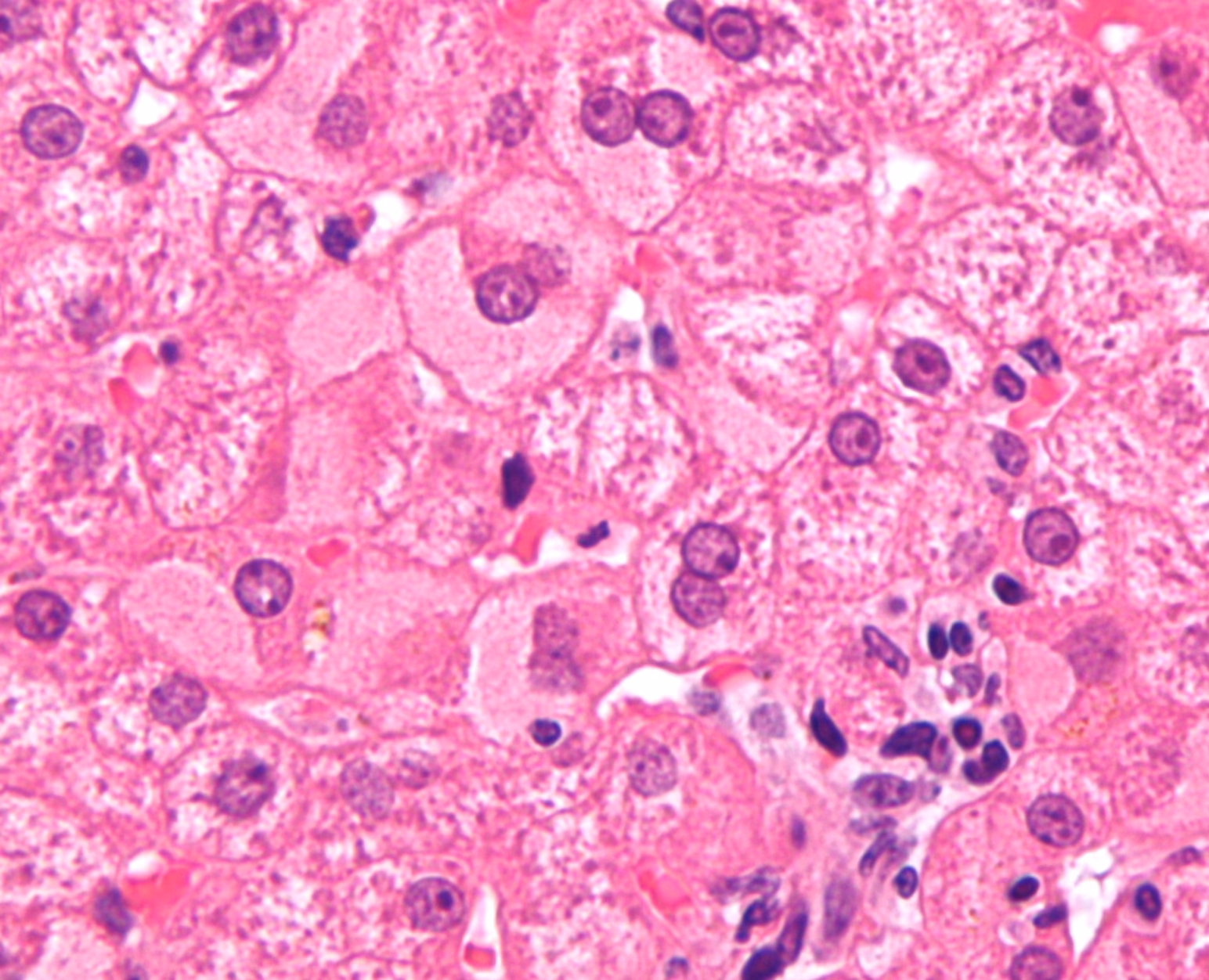 Where does hepatitis A come from?