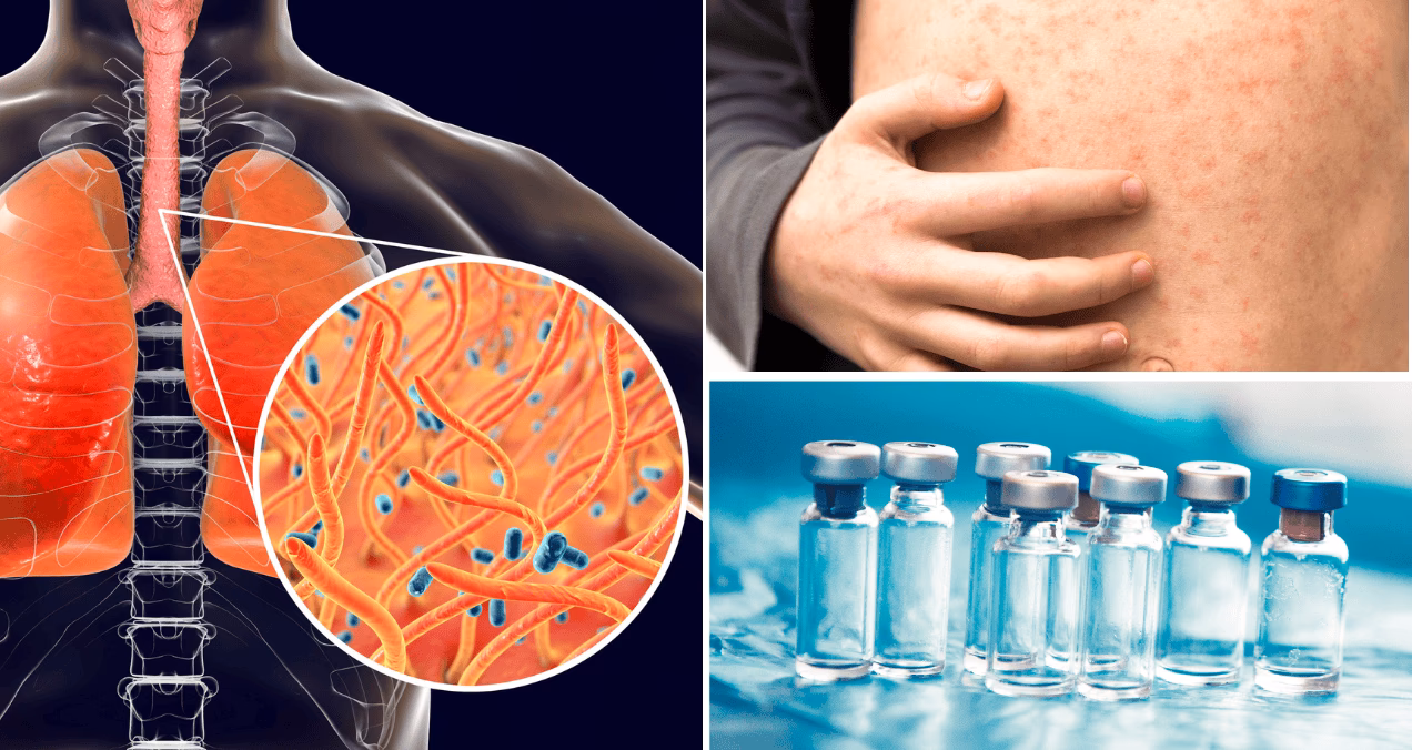 ¿Cuáles son las diferencias entre difteria y hepatitis?