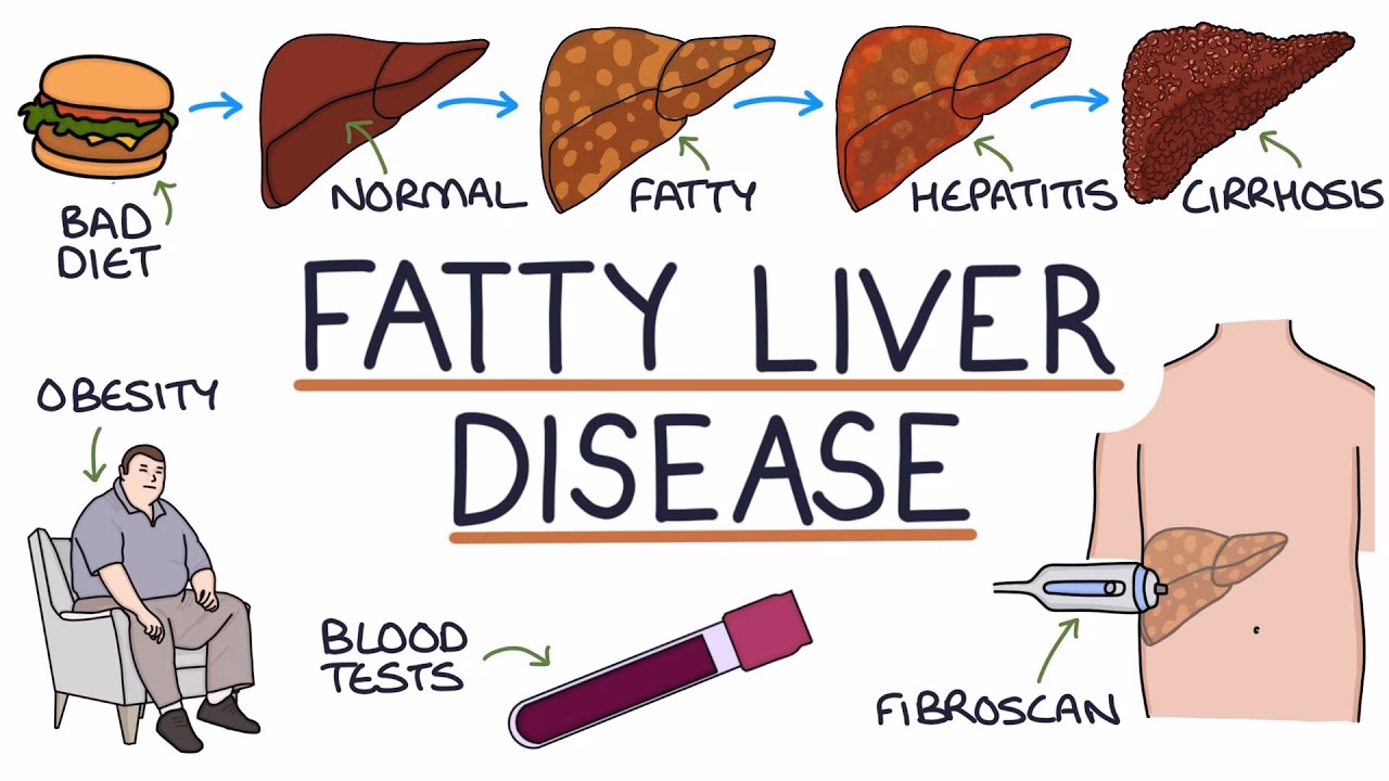 How can hepatitis remission be achieved?