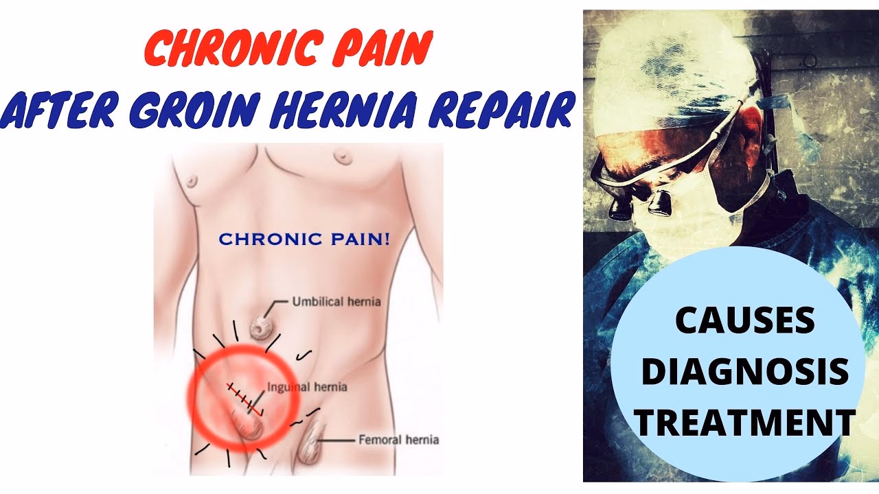 How to manage pain after a hernia surgery?