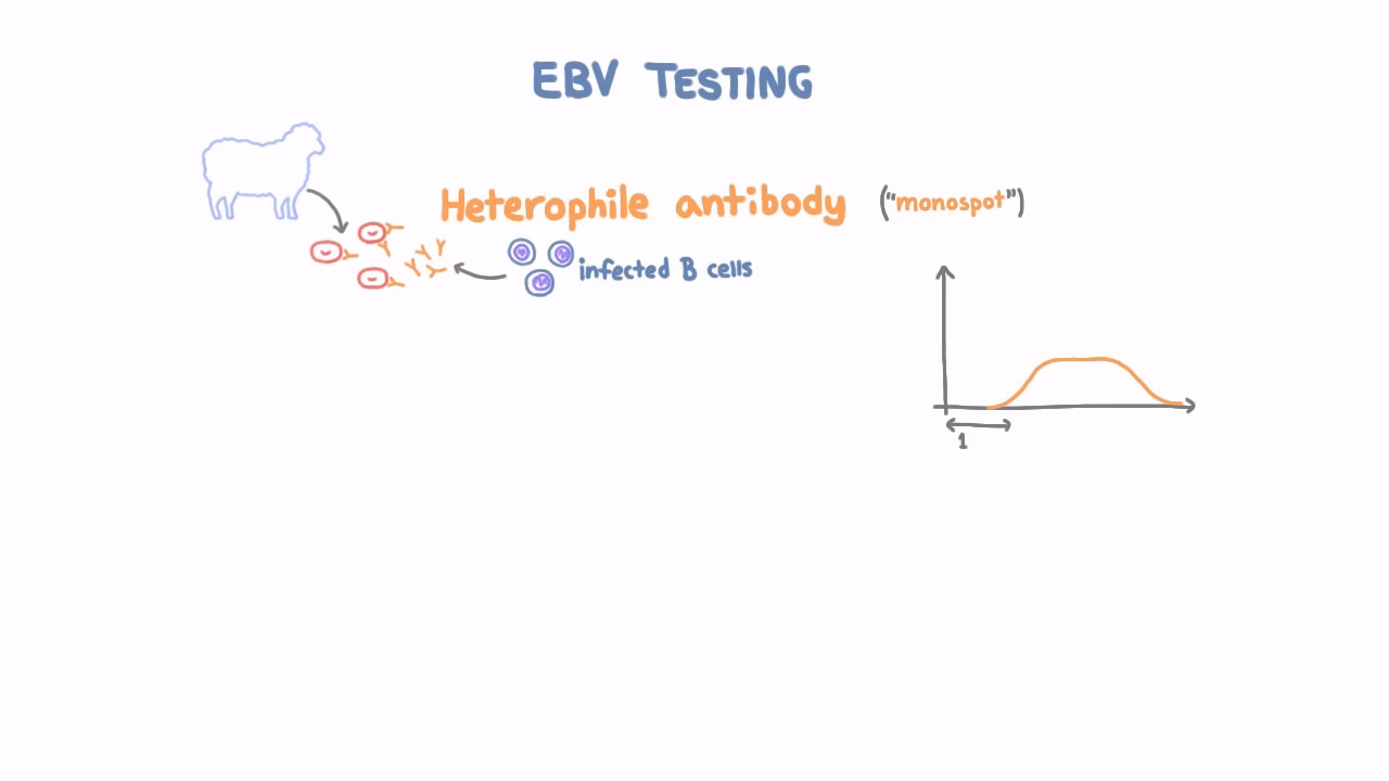 What antibodies are used to diagnose EBV?
