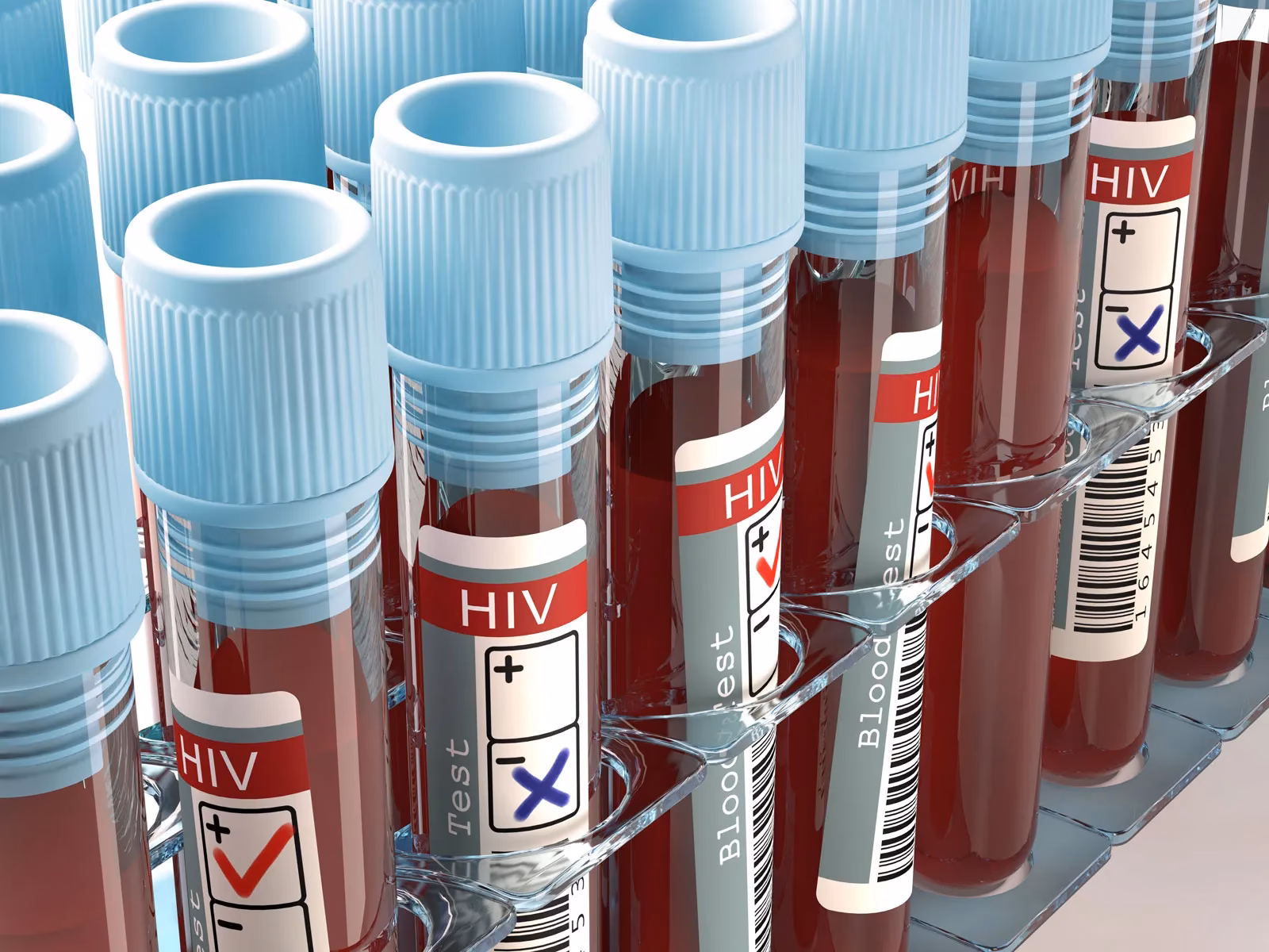 What are hematologic abnormalities in HIV?