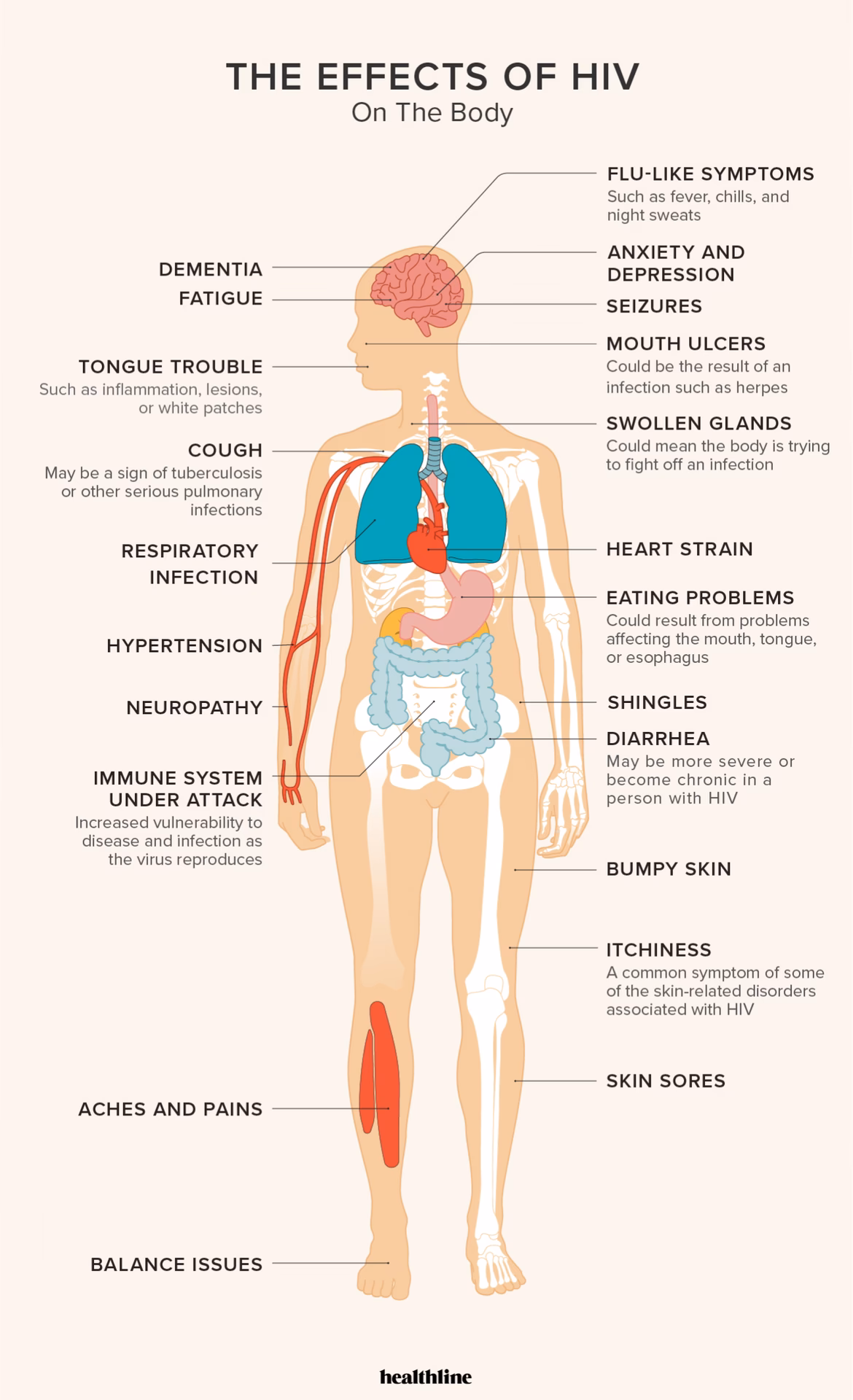 Does HIV cause headaches?