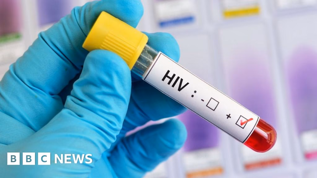 Is the world closer to a cure for HIV?