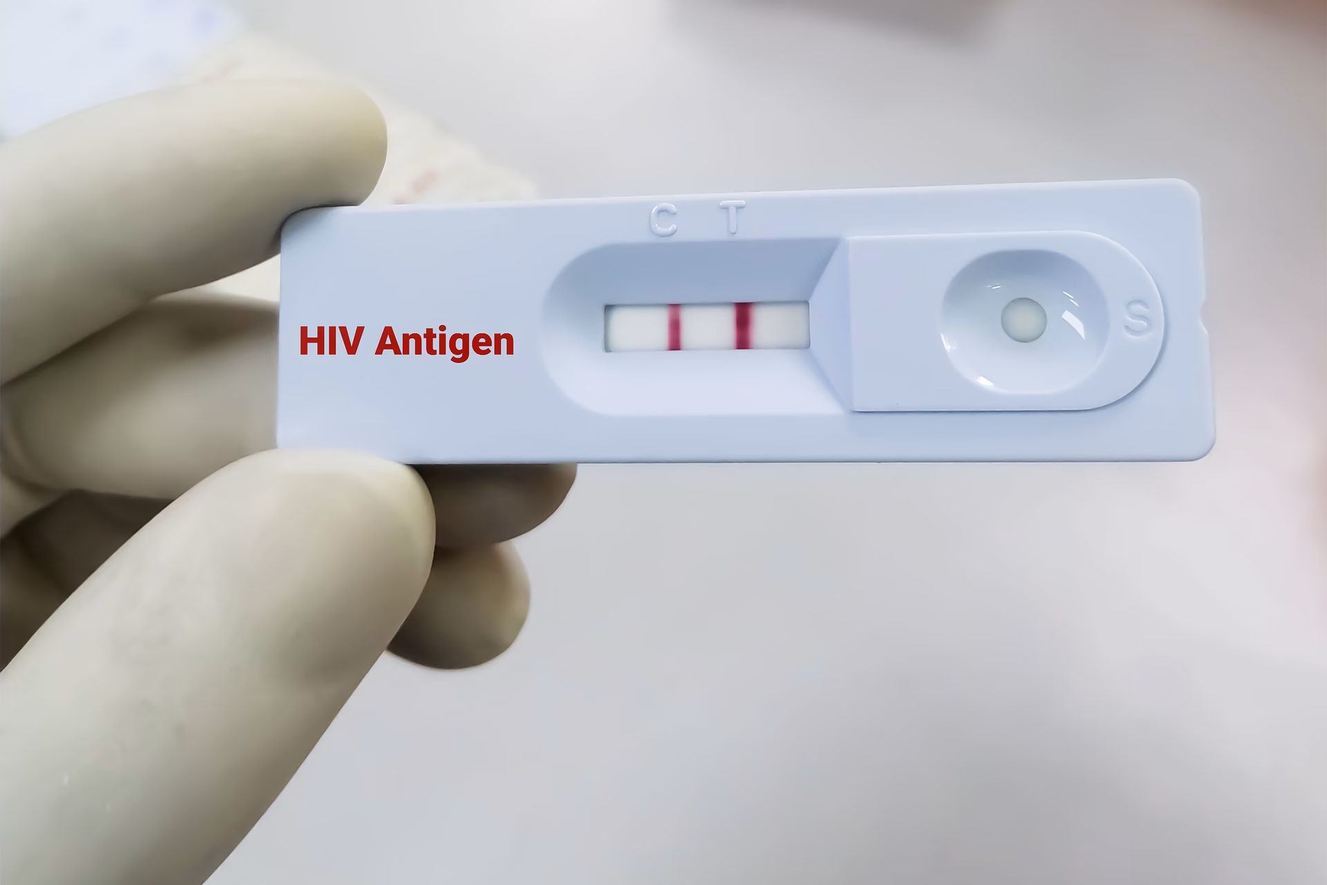 What does a HIV test show?