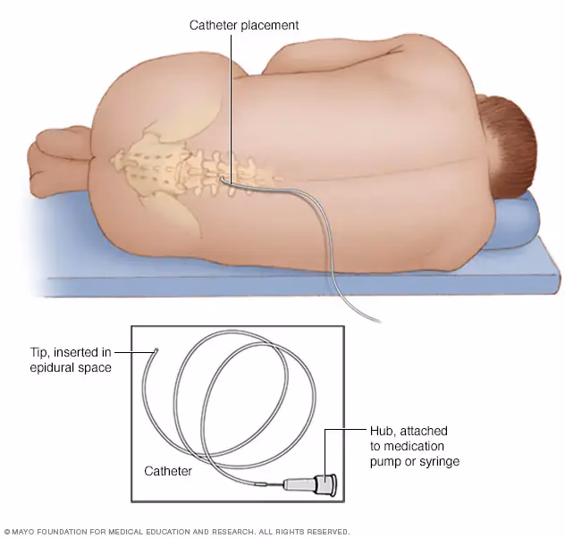 How important is acute pain management in hospitalized patients?
